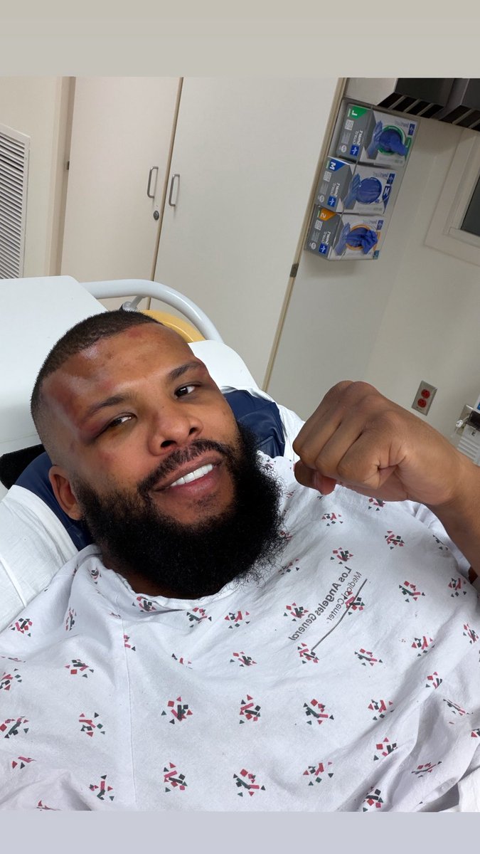 BadouJack's tweet image. Today wasn’t our day. But alhamdulillah I will keep my head high. Congratulations to the new champion @noelmikaelian 
I’m in the hospital now with a fractured cheekbone from the headbutt in the middle of the fight. But Alhamdulillah everything is fine. Thanks for all the support