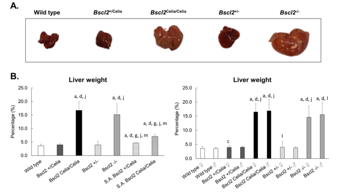 Info_Rares's tweet photo. 🧬Seipin (BSCL2) deficiency drives early #MASLD/#MASH and fibrosis in lipodystrophy 🐁 models, with up to ~20-fold FGF21 upregulation.
These findings point to FGF21 pathway as a promising therapeutic target.
Congrats, happy to @uetemlab team!
@IJMS_MDPI 
https://t.co/AX70kqXVYw https://t.co/IG0zTXtX03