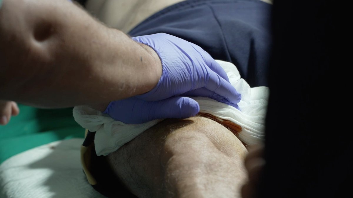 Acompañamos a un equipo médico en un día de festejo popular. La importancia de la actuación desde el percance hasta la llegada a quirófanos es clave. 

🟥 En directo bit.ly/DirectoTierraD…

📲YouTube y App 
<a href="/cextremadura/">Canal Extremadura</a>