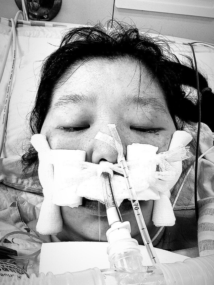 tora_amano's tweet image. HPP 25周年おめでとうございます✨
25年間の間に、数回ツアーご一緒できて光栄ですし、ファン歴17年目でとても嬉しく思います。

血管が破裂したせいでHPP 25周年ライブ行けなくて悲しかった💔VORCHAOS、exist†traceも観たかった😭Mardelasのライブも行くつもりでしたが...🥲
ひとまず生きてます。