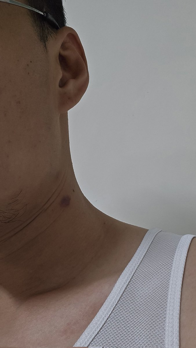 Anoddguy tweet media