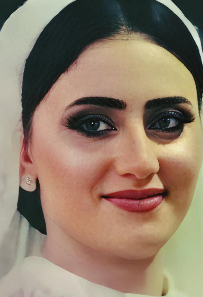 تقرير الطب الشرعي لعروسة المنوفية كريمة على لسان محامي الأسرة الاستاذ أحمد طلبة 

كسـ ـر في عظمة القص ودي بتكون في القفص الصدري لحماية القلب والرئتين بسبب ضـ ـرب بالقدم؛ مما أدى إلى نزيـ ـف في الرئتين وتوقف التنفس اللي أدى بدوره لتوقف عضلة القلب، نزيـ ـف وإجهـ ـاض الطفل نتيجة ضـ