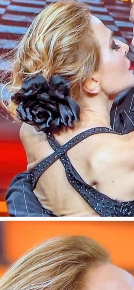 Quando non ha le sue luci e guardandola poi bene ella foto di schiena si vede la pelle floscia …… e nella prima sembra ALIEN LA VENDETTA . BUFFONA BUGIARDA  VATTENE