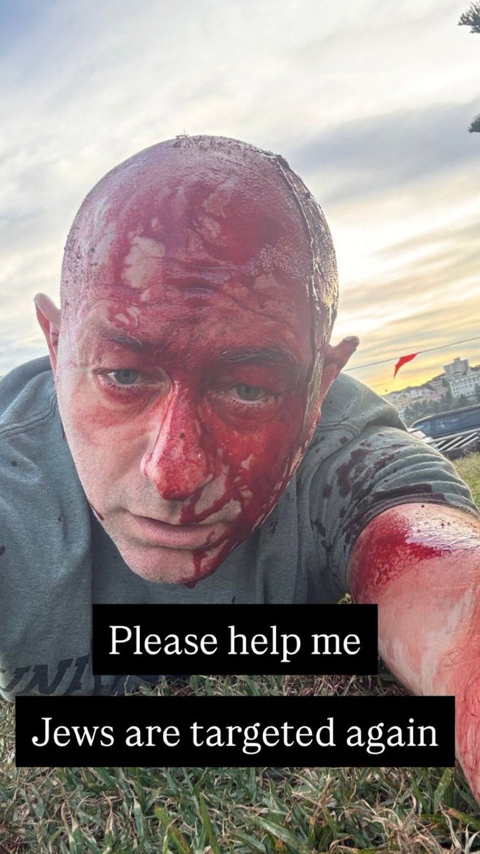 Villgecrazylady's tweet image. He survived 10/7 and Bondi beach? That’s wild. Same as that girl from Brown yesterday who also survived Parkland. Crazy times.