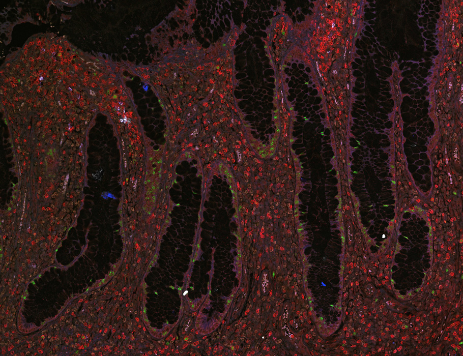 A new Science #Immunology study provides insight into how the immune composition of the human intestine varies in health and inflammatory bowel disease (#IBD), which could inform future therapeutics. scim.ag/4a7fj4J