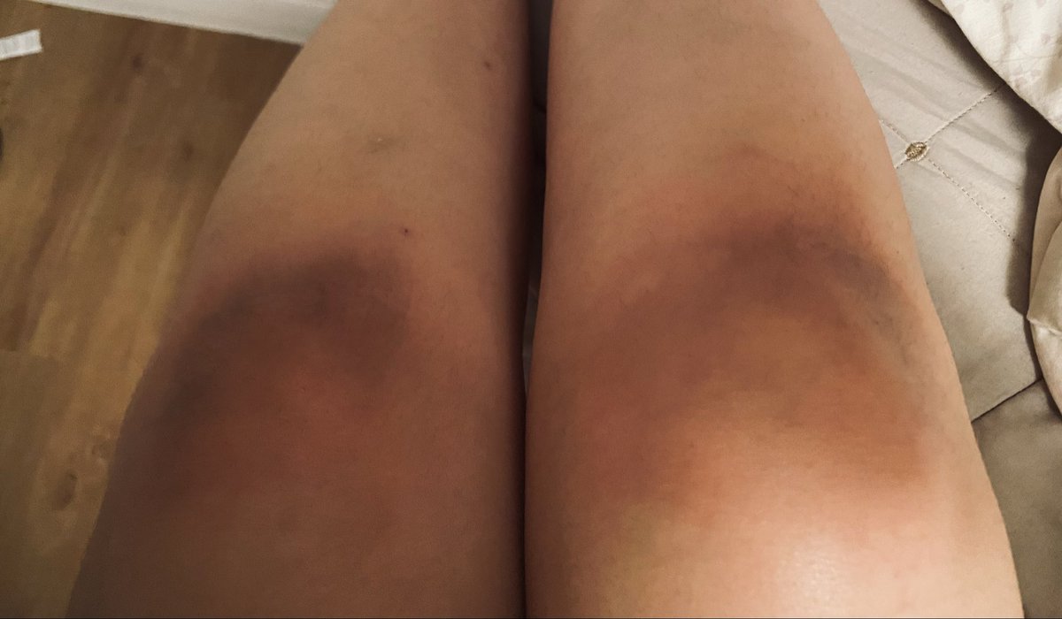 leaodolu's tweet photo. aconteceu, hoje fui cumprir minha promessa. 
A dor no joelho virou uma detalhe quase que irrelevante perto da emoção de saber que eu estava ali porque fui ouvida. Porque alguém lá em cima intercedeu por mim quando eu só tinha fé…+ https://t.co/bFcSqdEjvd