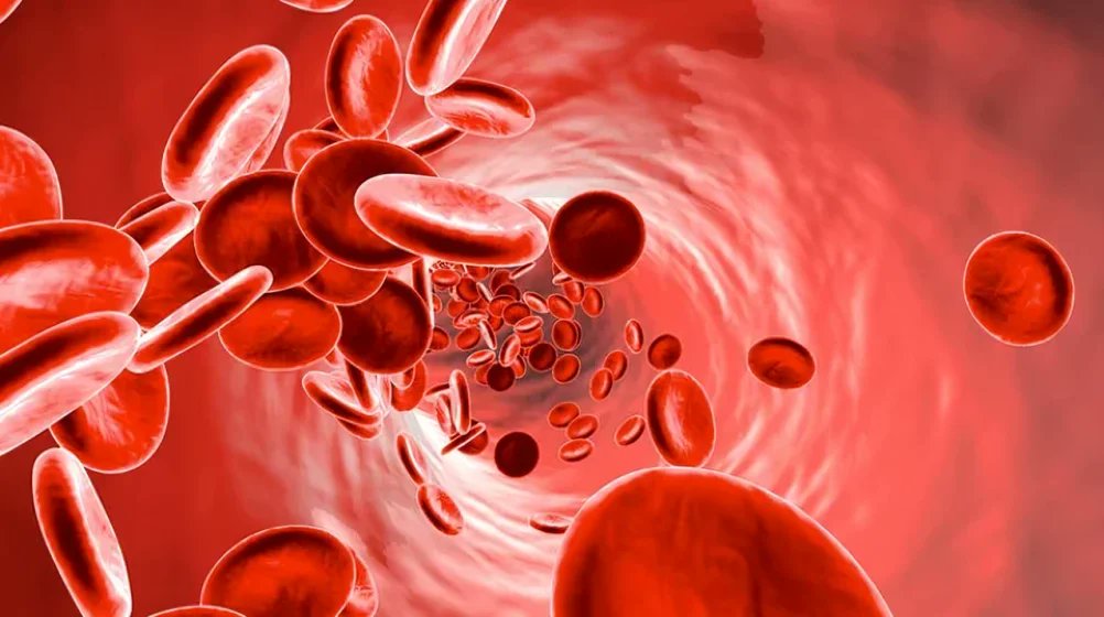 HemostasisToday's tweet photo. Laboratory Diagnosis of Anemia - Dr. Tareq Abadl
https://t.co/RKkBKLJdNy
#Anemia #Ferritin #Health #Hematocrit #Hemoglobin #HemolyticAnemia #HemostasisToday #Medicine #IronDeficiencyAnemia #RBC #Reticulocyte #TIBC #TotalIronBindingCapacity #TransferrinSaturation #MedEd #MedX https://t.co/CtIknDLzyB
