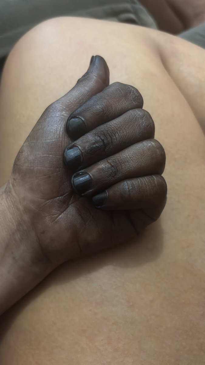 JessyPrataa's tweet photo. A meta era fazer as mechas pro ano novo, mas eu sou agoniada…. Pintei de preto azulado e sem luva ainda 🫠 https://t.co/LwheTc3KiR