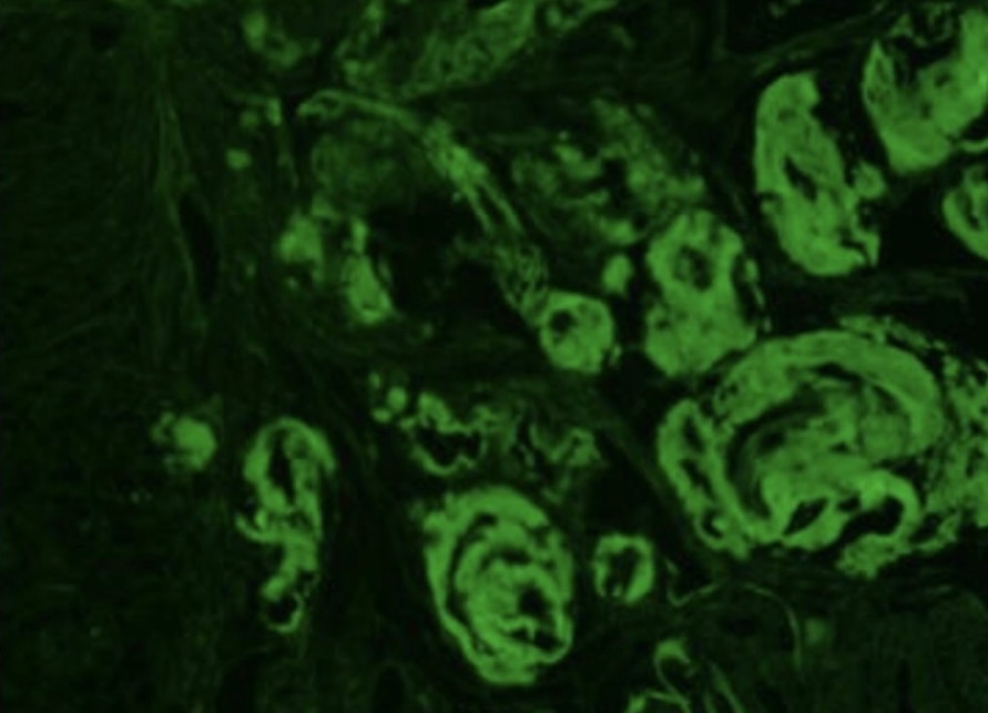 ◯必修対策 🔵染色法の問題 アミロイド⭐️の染色はコンゴーレッド