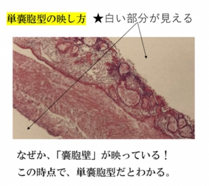 119回歯科医師国家試験対策 ロムニーハウス勉強会【講師 Dr.N