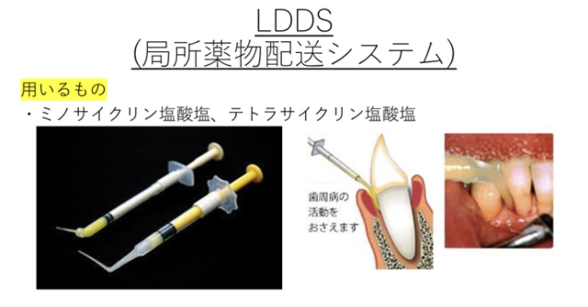 119回歯科医師国家試験対策 ロムニーハウス勉強会【講師 Dr.N