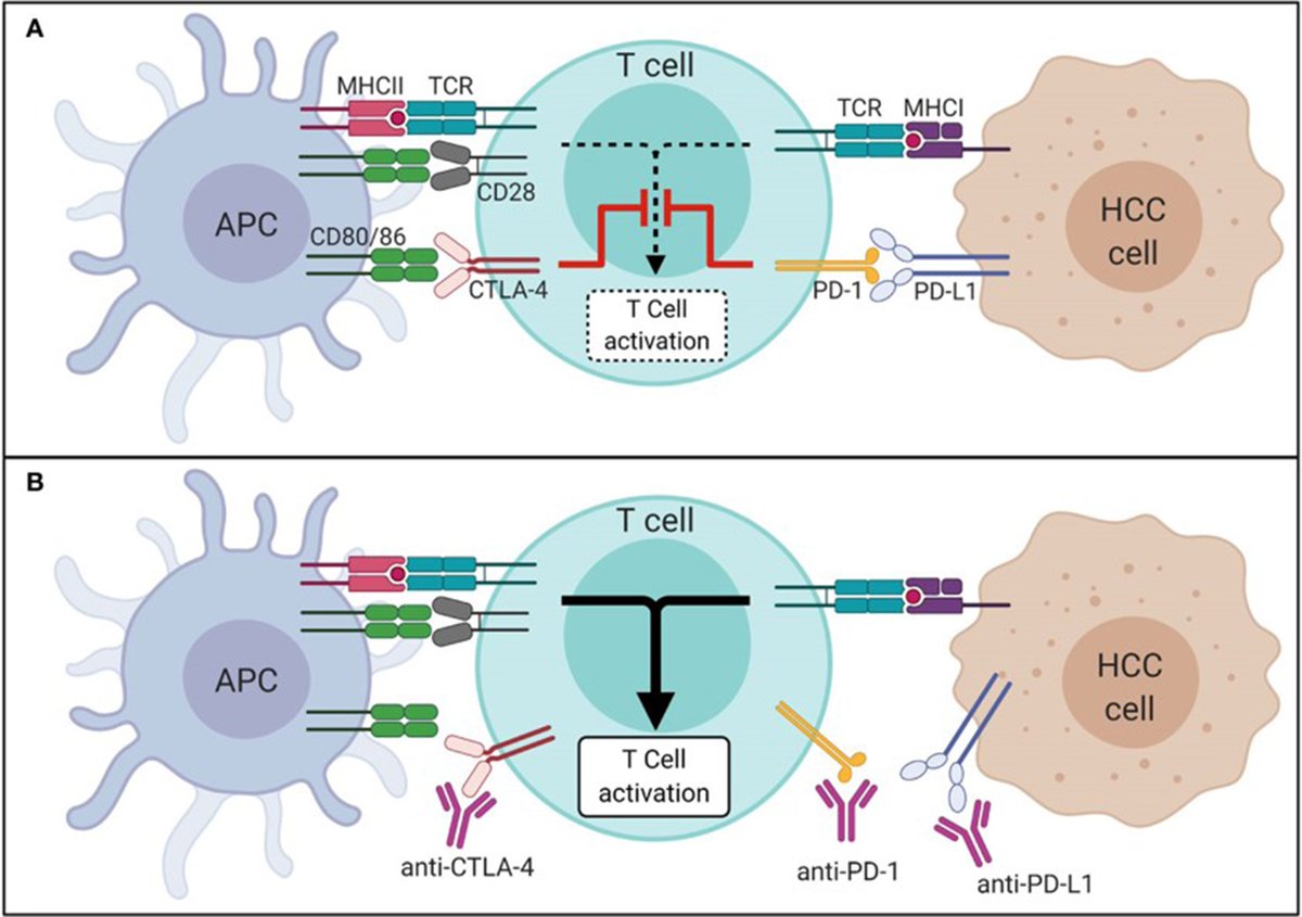💉 Immune Checkpoint Inhibitors and Yttrium-90 Radioembolization in #HepatocellularCarcinoma: Sequencing Challenges

🔁 Sequencing ICIs with locoregional therapy
🎯 Optimizing response and safety
 💡  Toward personalized treatment strategies

🔗 [oaepublish.com/articles/2394-…]