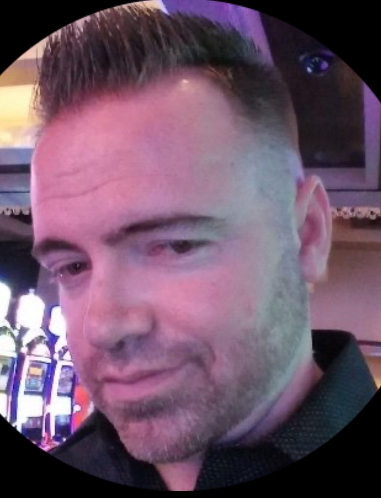 oniincteam's tweet image. At least imma have hair in 5 years buddy