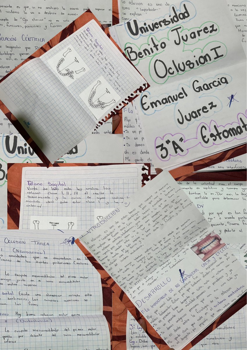 EmanuelGarubj's tweet photo. #oclusion
#marcoantonio
#ubj
#collage https://t.co/9ka2lxV0XN