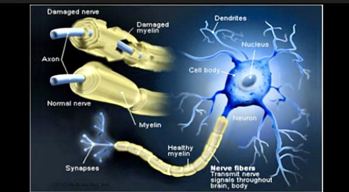 bridgeout's tweet image. What a #journey I have had over the past years wanting to #understand and #cope with #CIDP …as I study tentative words that have been given to my #grief and #loss. 

livewithcidp.blogspot.com/2025/12/unders…