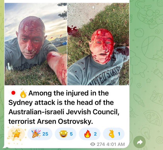 gutturalguffaw's tweet photo. @OrenMarmorstein @Ostrov_A Just got shot in the head, what a good time to snap some selfies for
Next years Hasbara campaign to help me pressure governments for new
Special Privilege, I mean, antisemitism laws https://t.co/eggTdfYf4s