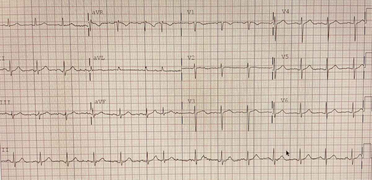 Asanka Migelheva tweet media