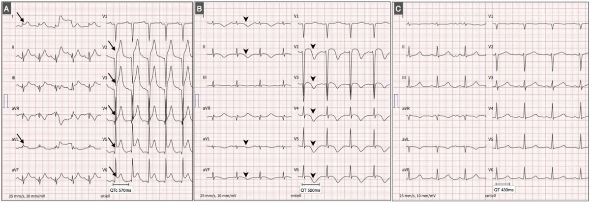 Cardiovascular Medicine tweet media