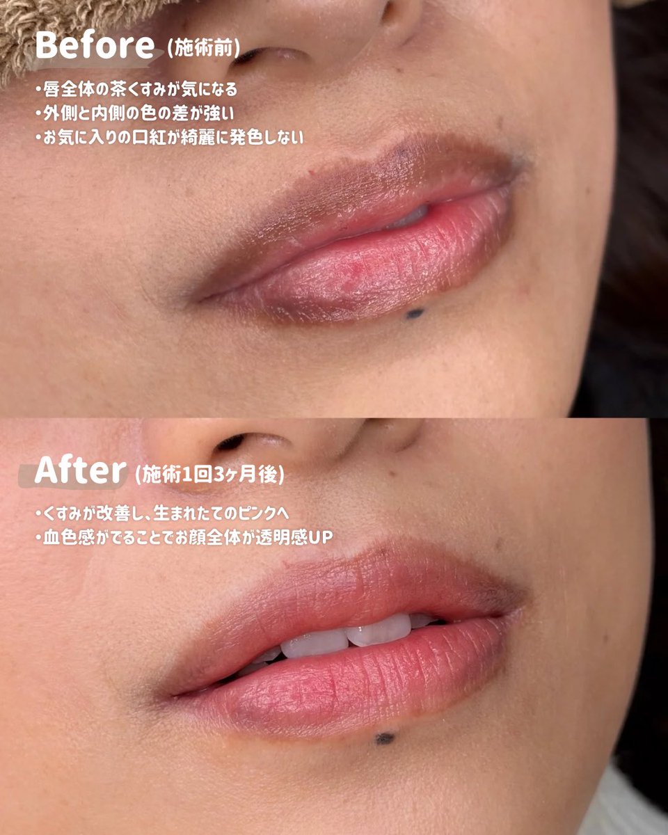 きくた | アートメイク・アマラピンク(大宮・恵比寿) (@kikuta_artmake