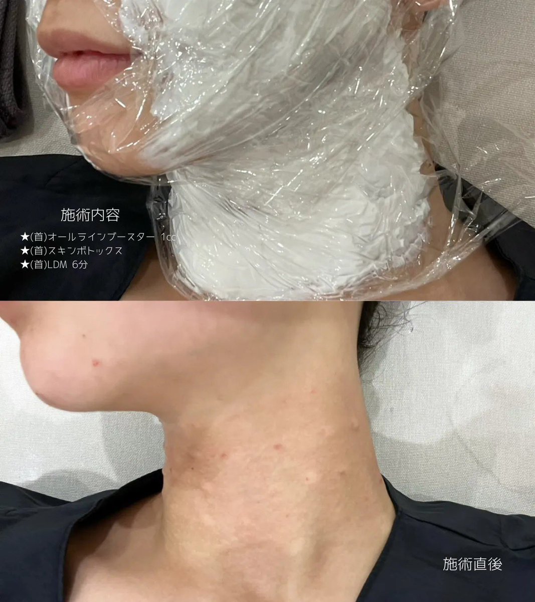 ぽんちゃん tweet media