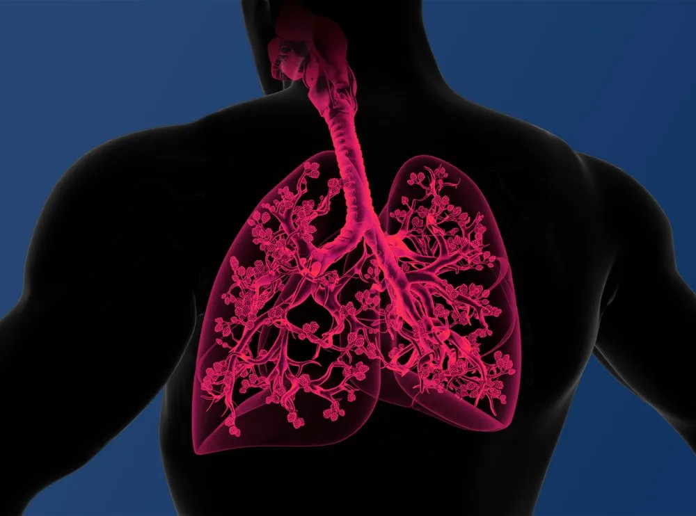 AB_drmd's tweet image. 🚨🚨🚨ليش الإفراط في إعطاء الأوكسجين لمريض COPD ممكن يكون خطير؟؟؟