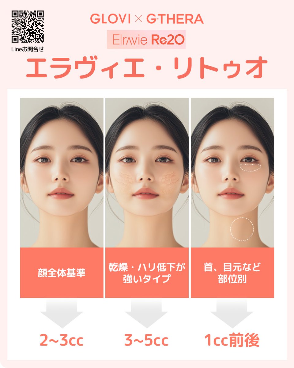 gthera_jp's tweet photo. 💧エラヴィエ・リトゥオ
副作用の心配を抑え、肌本来の力を引き出すスキンブースター。
乾燥・ハリ低下が気になる方に。
肌状��に合わせたオーダーメイド施術で、自然な変化を。
#エラヴィエリトゥオ #スキンブースター #美肌治療 #韓国美容 https://t.co/u96jcqmaS4