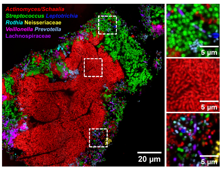 ASMicrobiology's tweet photo. #MicrobiologyMonday: Seeing all bacteria in a biofilm is tough—G+ cells walls block probes, and fixes harm G- cells. A new method slices bacteria embedded in plastic resin, letting probes in without damage for clear visualization. #JournalSpectrum:
https://t.co/p8bmrbKrzL https://t.co/BeJxoPdbf8