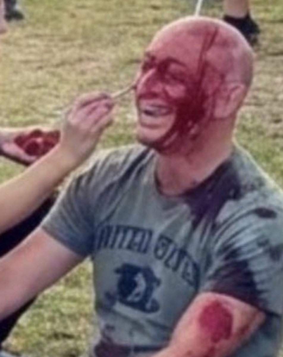 ‼️🇦🇺 This AI image is going viral to prove that the Bondi Beach shooting didn’t actually happen and Arsen Ostrovsky faked being shot in the head.

The makeup artist has extra fingers and Arsen’s shirt has gibberish letters on it.

X needs to flag accounts that push this stuff.