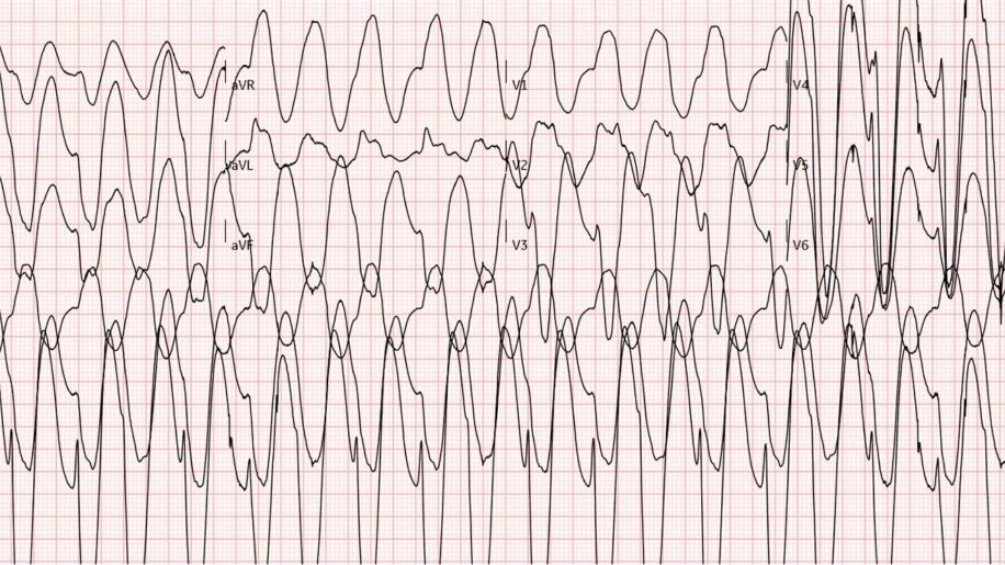 ECGWeekly tweet media