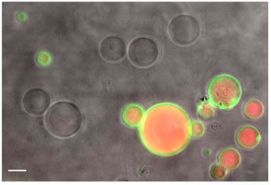 NikoMcCarty's tweet photo. "A synthetic cell phage cycle."

This paper shows the first viral lifecycle (from infection to replication to release) achieved using synthetic cells.

A bacteriophage is a virus that infects bacteria. This study focused on T7, which infects strains of E. coli. The typical phage lifecycle goes like this:

1. The phage lands on a cell membrane, latching onto lipopolysaccharides which branch out from the surface.

2. T7 injects its genome into the cell. The cell "reads" this DNA, copying it and using it to build more phages.

4. Phages get assembled. T7 has a head, a double-stranded DNA genome, and tail tibers which grab onto cells.

5. The phages are released; often they literally "blow up" the cell and rush through the opening.

These steps seem relatively straightforward, but no studies before this one have done all of them in synthetic and enclosed cells. Many other papers, though, have managed to make phages in test tubes; it's just that they didn't include the infection or release steps.

For this paper, the authors first made little "bubbles" by mixing fats and lipids and then embedded modified lipopolysaccharide molecules on their surfaces. They filled these bubbles with cell-free extracts, made from squished/killed E. coli cells. (So this is cheating a bit; it's not truly a chemically-derived, synthetic system.)

Next, they modified T7 phages so that their genomes encoded a red fluorescent protein. This way, they could track infections over time, as infected bubbles became a darker red color.

The phages were added to the bubbles and infected them over ~4 hours. To get the new phages *out* of the bubbles, the authors cheated a little (again) by quickly adding salt to trigger an osmotic shock that blew up the bubbles.

One interesting thing here is that Arthur Kornberg (Medicine Nobel, 1959 for discovering DNA polymerase) once imagined exactly such a "synthetic" virus lifecycle, writing in 1974: "Despite the extraordinary complexity of the viral life cycle, its dissection and eventual reconstruction with chemically defined components in a cell‐free system from start to finish remains an attractive prospect."

The next step here, of course, will be to get the phages to release from cells on their own and to extend this to other phages or viruses. The point of this work, I'd say, is mostly basic; it's an ode to the old Feynman adage: "What I cannot create, I do not understand." This, at least, proves that we understand all the components of a T7 phage lifecycle. In building synthetic systems for other viruses, we can figure out what we know -- and don't know -- for them as well.

In terms of applications, this approach also makes it easier to study viral infections in a more controlled and repeatable way; researchers can make tons of variables and screen for their impacts much more quickly, all without without having to grow / rely on the intricacies of living cells.