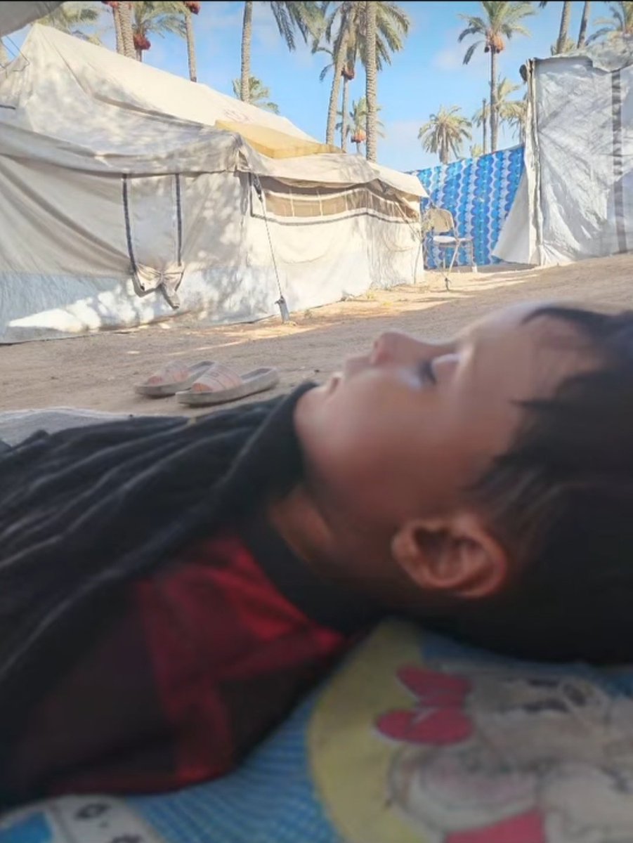 My child’s surgery to remove the tonsils and adenoids was supposed to take place today, after they caused heart enlargement and severe breathing difficulties🙏.

However, acute chest infections forced the doctor to postpone the surgery for several days, in the hope that the X-ray