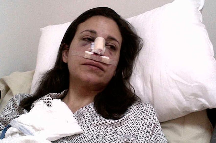 La mitomana dice ahora que sufrió una "fractura vertebral" cuando salía de Venezuela rumbo a Oslo.
Ese cuento se parece al de la "fractura nasal", que simuló hace unos años y se descubrió que todo era un teatro para victimizarse.
Puro show y mentiras.