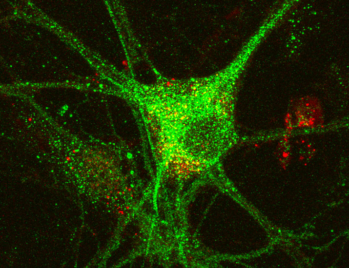 Researchers in @SciSignal report that calcium channels in rodent hippocampal neurons are an important target in dopamine receptor signaling, hinting that these channels could be targeted to treat neuropsychiatric disorders. scim.ag/3KGCMze