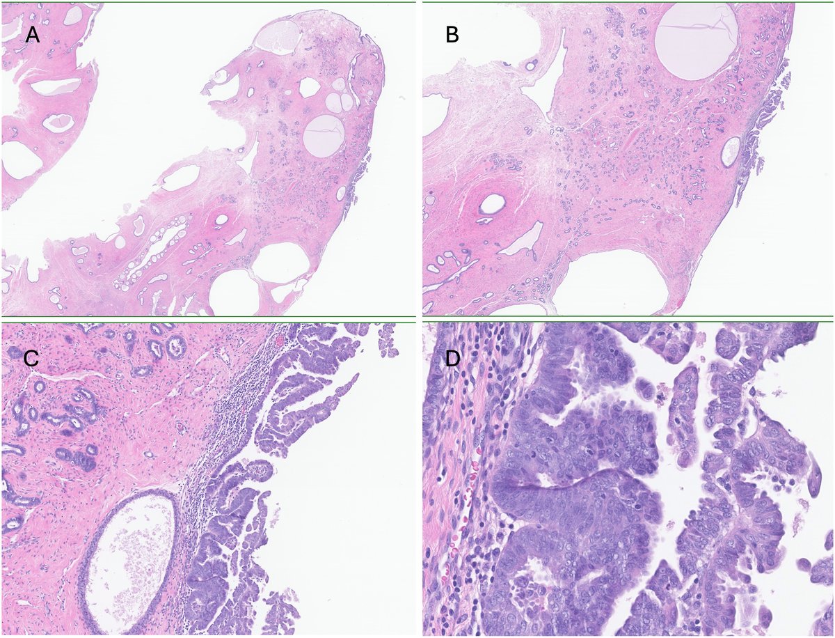 Human Pathology tweet media