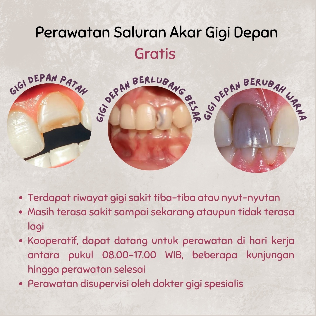 uppifess's tweet photo. !upi halo ada titipan dari koas gigi di bandung, apabila ada yang mengalami gigi depan dengan keluhan di bawah dan mau dirawat gratis, boleh reply ya!!☺️🤍 https://t.co/qsYWpF5v7E