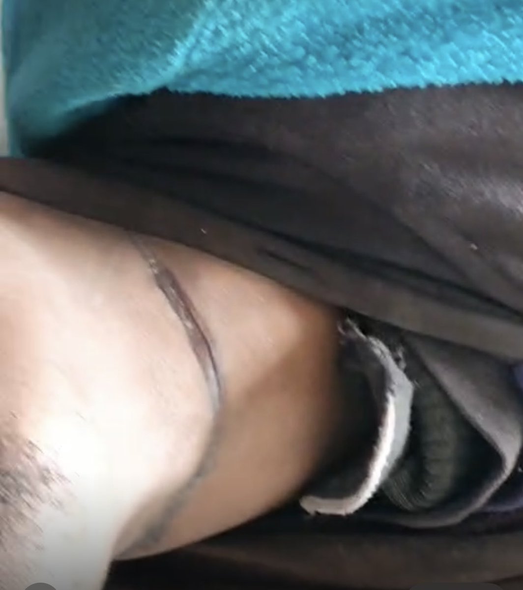 _James041's tweet image. Autopsy has been done on the body of Jack Leon Maloba. 

The autopsy has ruled out the use of a T-shirt for hanging claiming the mark left on the neck came from a narrower item like a wire.

 Police have now changed narrative saying that Jack hanged himself using a shoelace.…