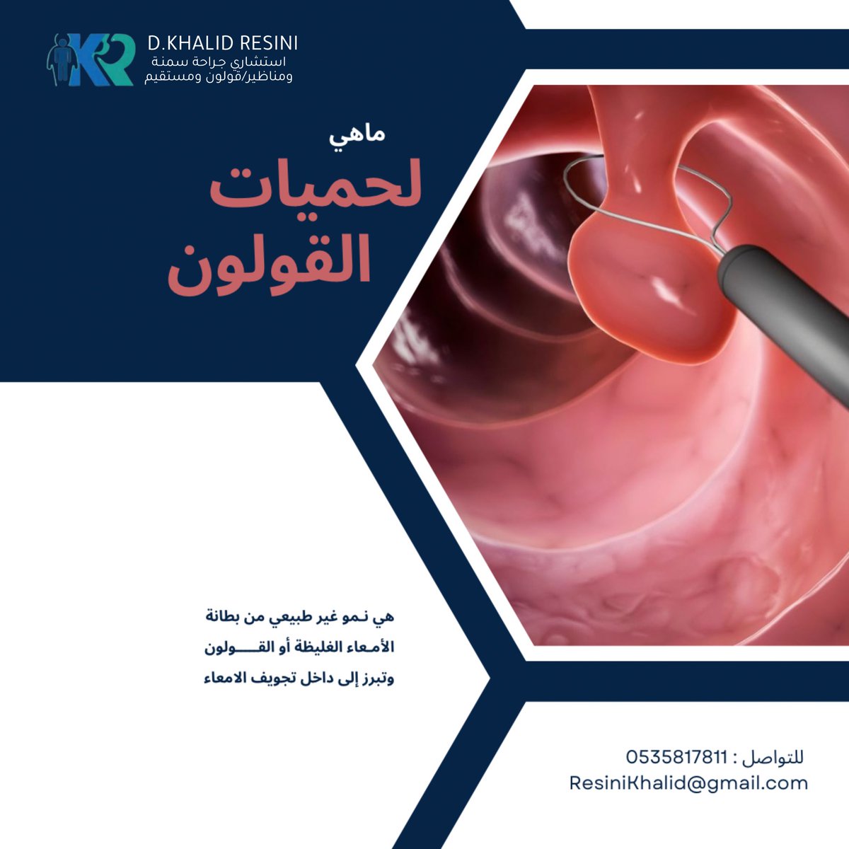 لحميات القولـون
ماهي ؟ والتشخيص المناسب👍🏻