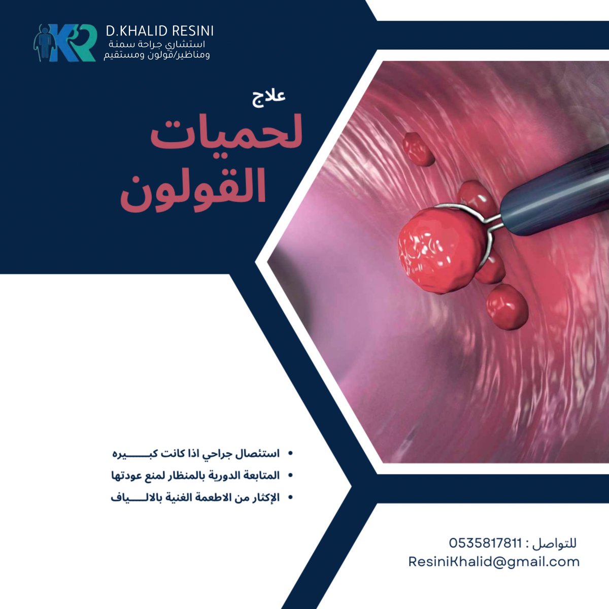 عـلاج لحميات القولـون