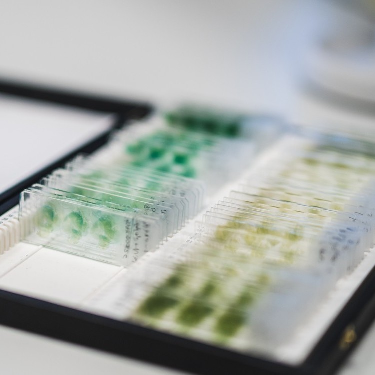 BrightFocus Foundation tweet media