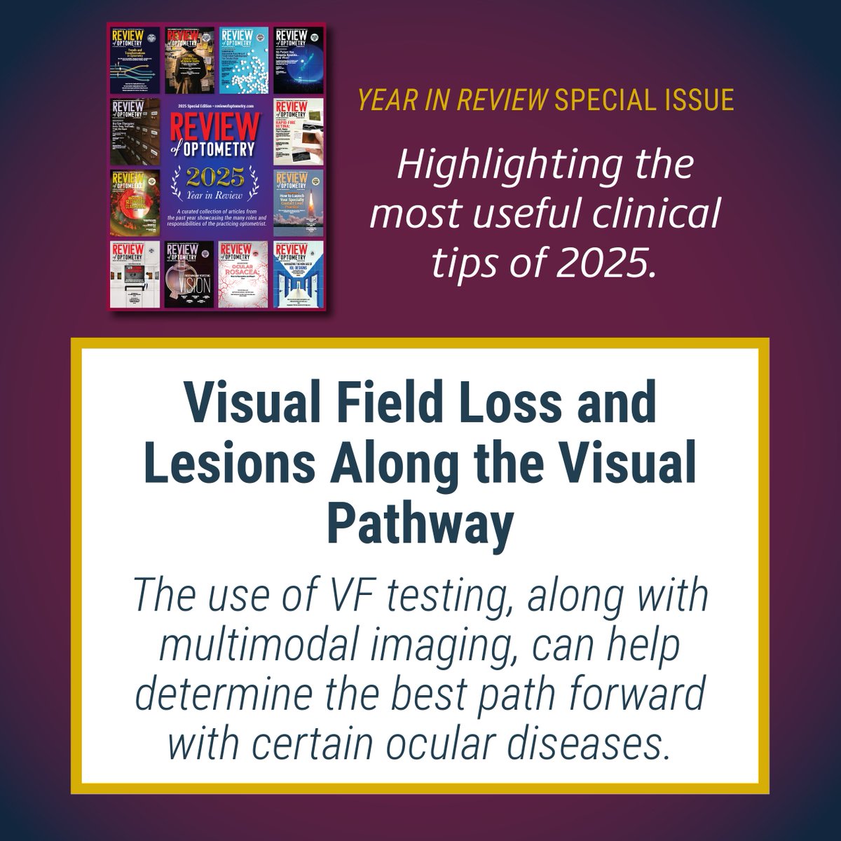 revoptom's tweet photo. Through mid-January, we'll be highlighting some of our magazine's top features and column installments from 2025. 

Here's one from our Feb. 2025 issue: https://t.co/SoPSCamUYK
#RO2025inreview #optometry #optometrist #visualfield #vision #retina #visionloss https://t.co/jS59q0ePHR