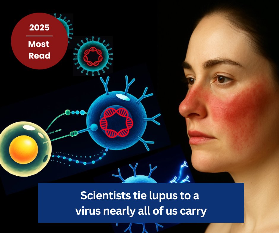 One of humanity’s most ubiquitous infectious pathogens bears the blame for lupus, the chronic autoimmune condition, Stanford Medicine investigators and their colleagues have found. #2025Recap ⭐
stan.md/4obGHC9