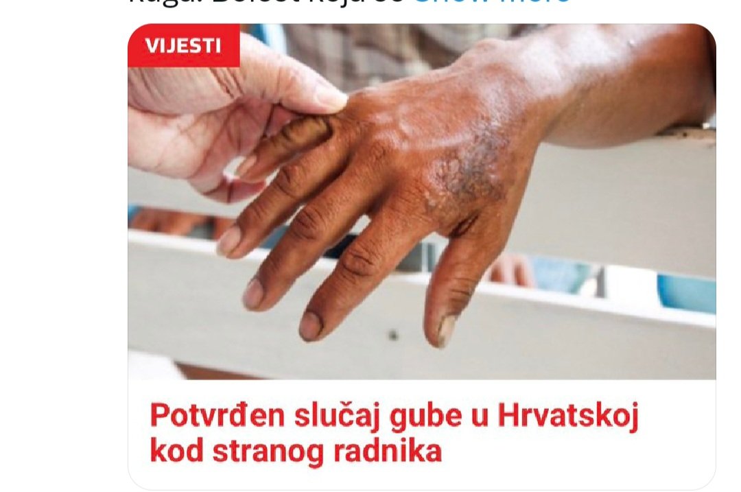 Mislila sam da sa radnom snagom iz Nepala dobijamo nosioce Hepatitisa B i side, ali u komšiluk već stigla guba...
A, samo je trebalo da imamo svest da  je bolje da našeg čoveka( koji ovde tu platu i troši ) poslodavci treba da plate pošteno.
Ali, pohlepa...izgleda da i ona ubija.