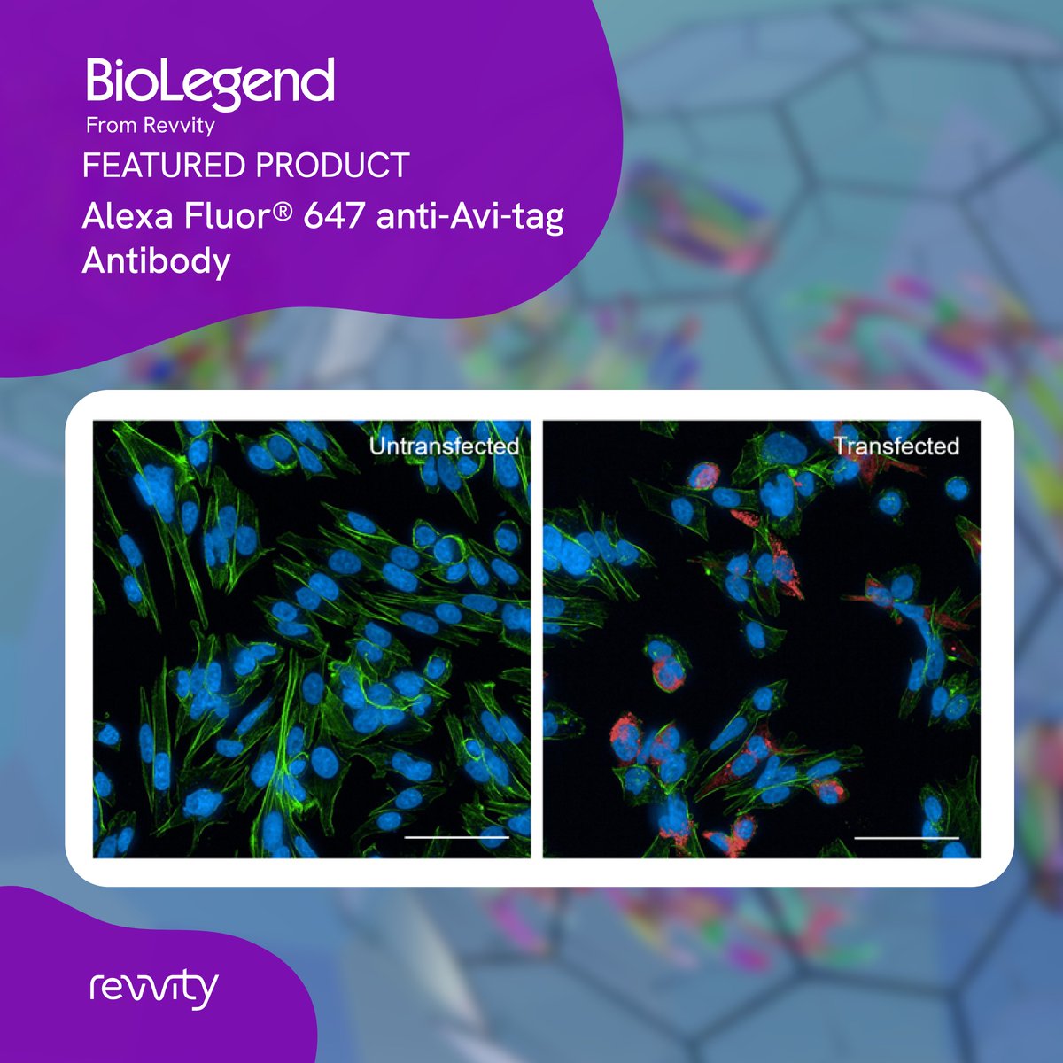 For #MicroscopyMonday, we're helping illuminate your tagged