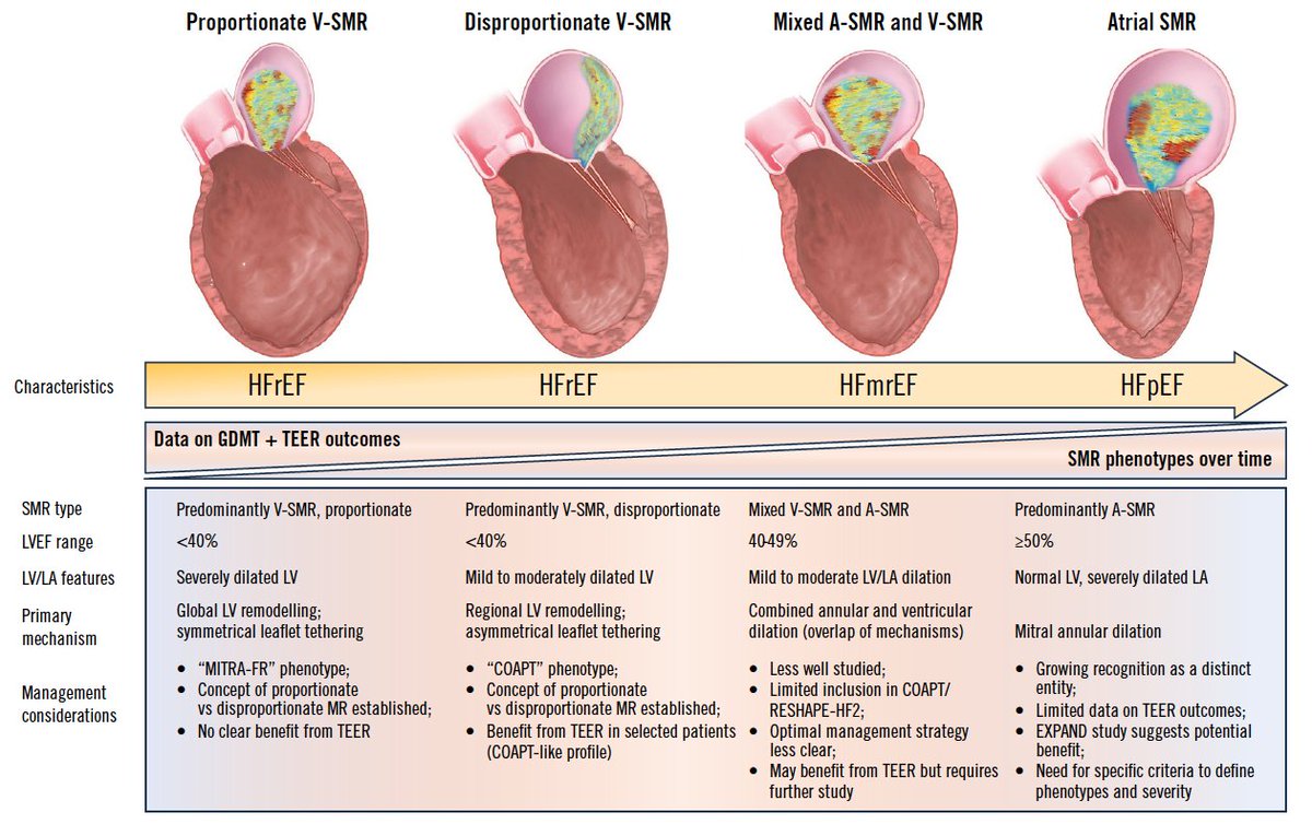 EuroInterventio's tweet photo. 📢 New in EuroIntervention: a comprehensive State-of-the-Art on transcatheter edge-to-edge repair (TEER) for secondary mitral regurgitation.
From evolving SMR phenotypes to trial data, device innovation, patient selection & 2025 guideline updates. 
https://t.co/Iu5BkMmUWs
#MitralRegurgitation #TEER #HeartFailure #StructuralHeart #InterventionalCardiology
@Jmparadis27 @TheHeartBeat3