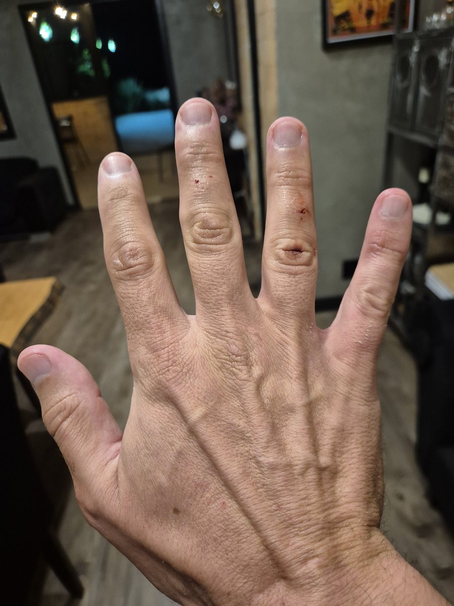 oiluiz's tweet photo. Levei um susto agorinha. Voltando pra casa de Uber, segurando o celular bem abaixo da linha da janela, para não chamar a atenção de bandido... e não adiantou. Do nada a janela explode ao meu lado e a mão de um vagabundo entra, tenta tirar o meu celular... mas eu passo tantas horas por dia segurando o celular pra trabalhar que acho que minha mão já se tornou um gancho, já se fundiu ao aparelho, e ele não conseguiu pegar. O vagabundo se afastou tão assustado quanto eu, me olhando com cara de trouxa ("isso nunca me aconteceu antes"), eu olhei pra ele e não me lembro de nada, mas a Bianca disse que eu gritei com ele e chamei pra briga haha. Enfim, dei sorte. Foi Deus. Ou a garra que minha mão virou. Voltei no banco da frente, xingando o Lula e o PT junto com o motorista.