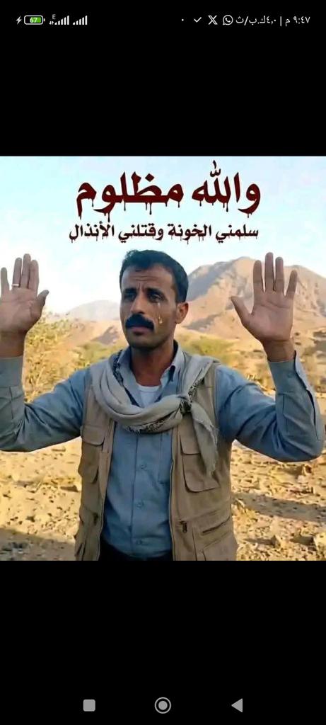 اجبن وانذل واحقرموقف حصل من عهدابوناآدم حتاهذه اللحظه والله انهاحلت عليهم العنه من هذه اللحظه حتاقيام الساعه لاعادلاشيم ولاقيم ولااسلاف ولااعراف ولادين ولامذهب المفروض ان هذا الناس الذي قاموابهذاالعمل الجبان انهم غرماءلكل قبايل اليمن ولامكان لهم فوق اراضي يمنيه ولاتربطهم اي صله