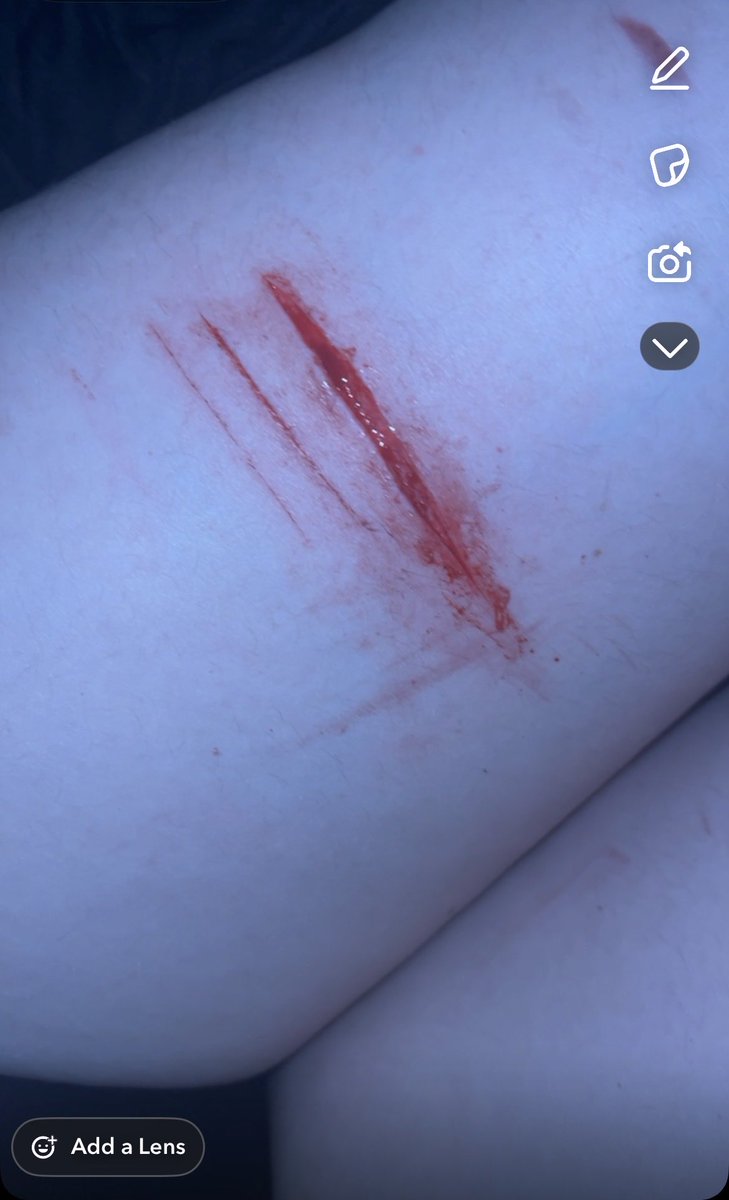 em1n3m33's tweet photo. Styrio/tinybabybeans 
I genuinely needed this so much people who don’t cut gen don’t get this feeling not even to sound cringe but damn
#shtw #selfharm #cringe #babybeans #styrio https://t.co/bNooCQ6Sla