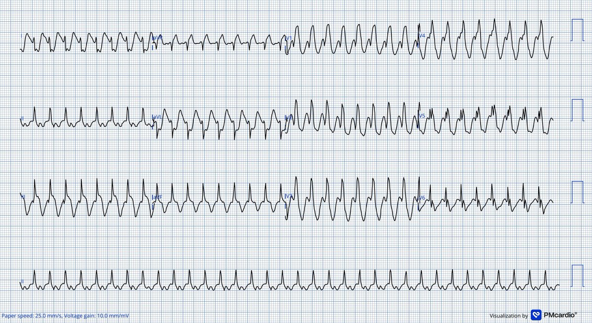 Cesar Salinas tweet media