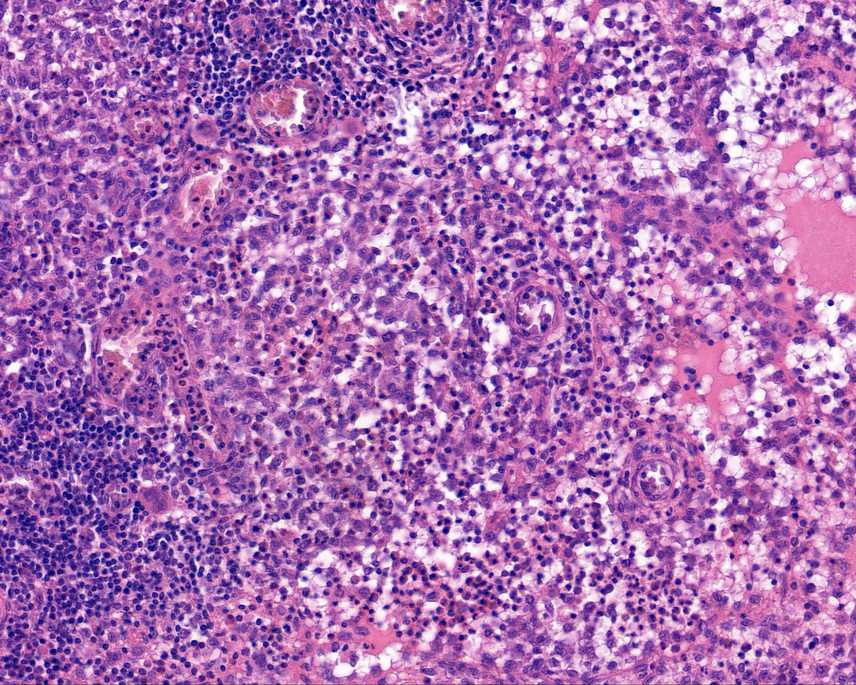 Surgical Pathology Cases tweet media