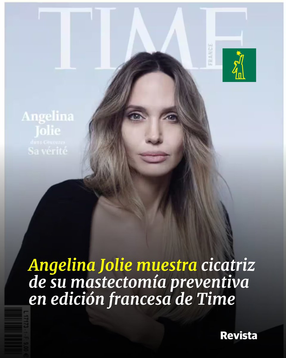 DiarioLibre's tweet photo. 📽 | #CineDL | La actriz estadounidense Angelina Jolie protagoniza el primer número de la edición francesa de la revista Time, donde muestra por primera vez la cicatriz de la mastectomía preventiva a la que se sometió en 2013 en coincidencia con la promoción de su nueva película, que trata el tema del cáncer

🔗https://t.co/AfiTzbOKBw

#DiarioLibre #Noticias #AngelinaJolie #Mastectomía #ActricesDeCine